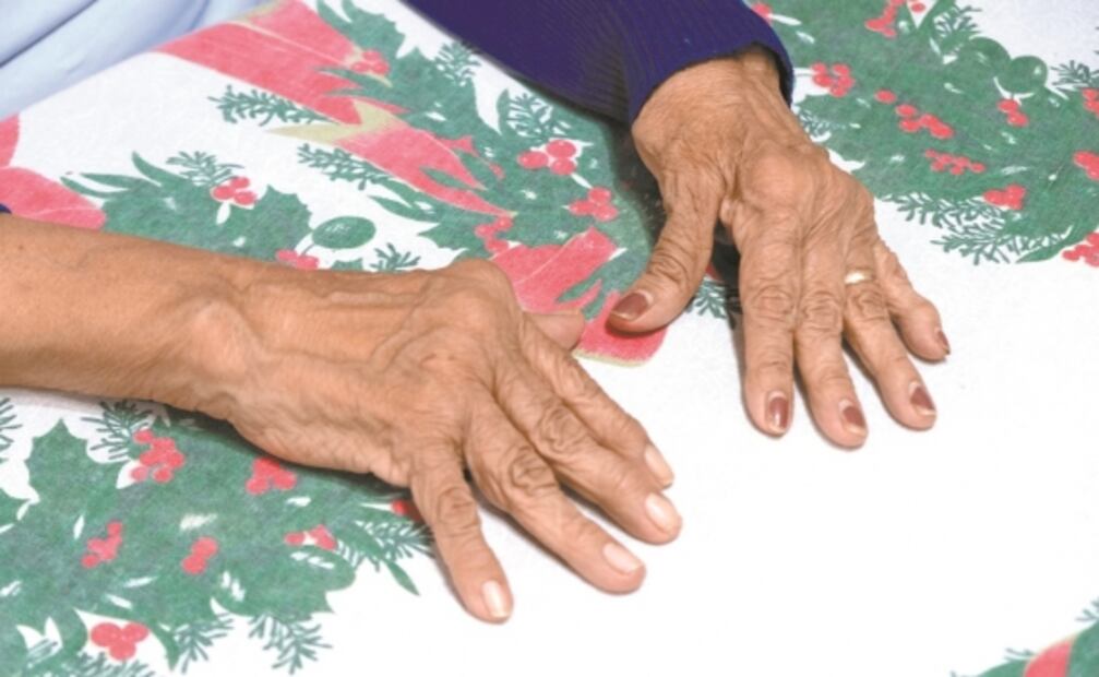 Dolor de articulaciones aqueja a yucatecos