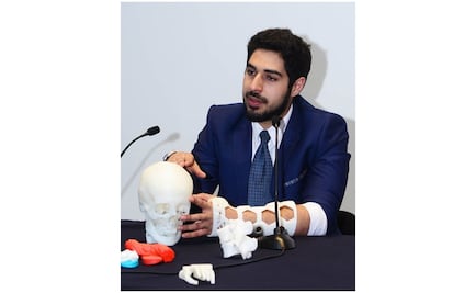 Alumno de la UNAM diseña "yeso" impreso en 3D