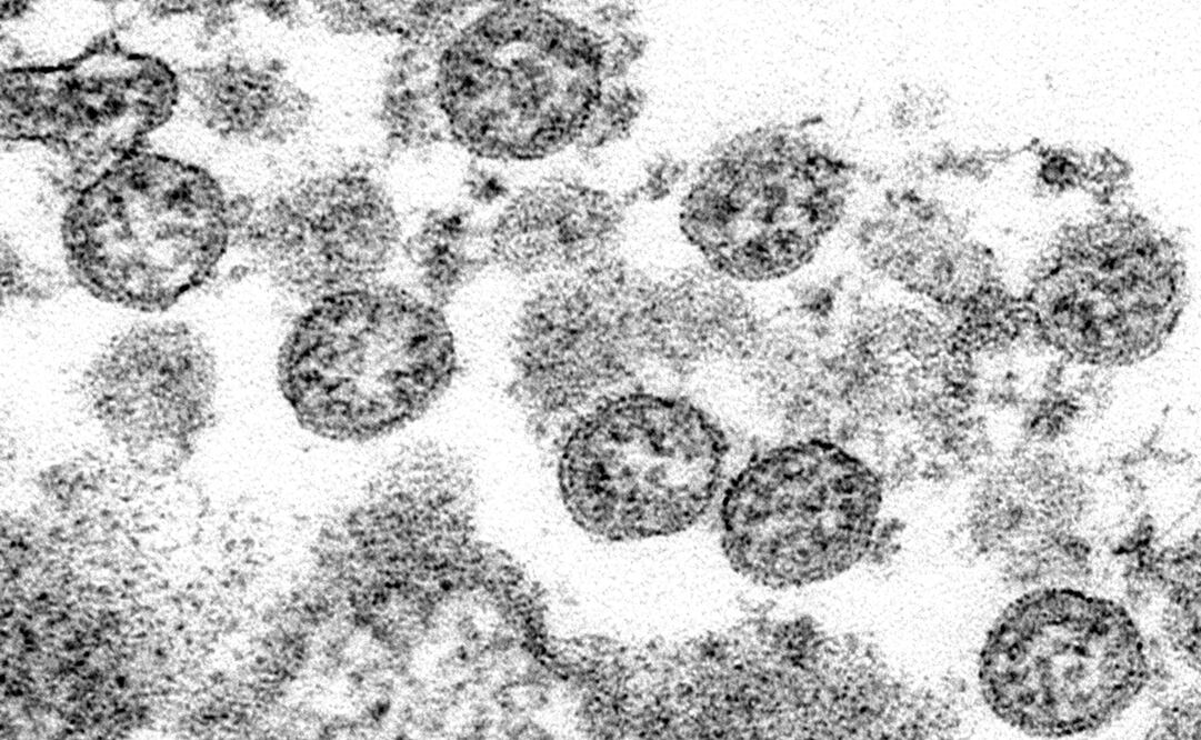 Foto: C.S. Goldsmith, A. Tamin/CDC via AP