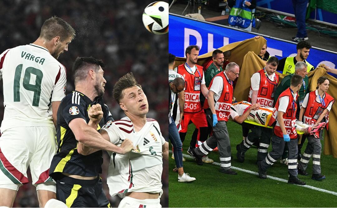 Barnabas Varga se rompió varios huesos de la cara y sufrió una conmoción cerebral - Fotos: EFE y AFP