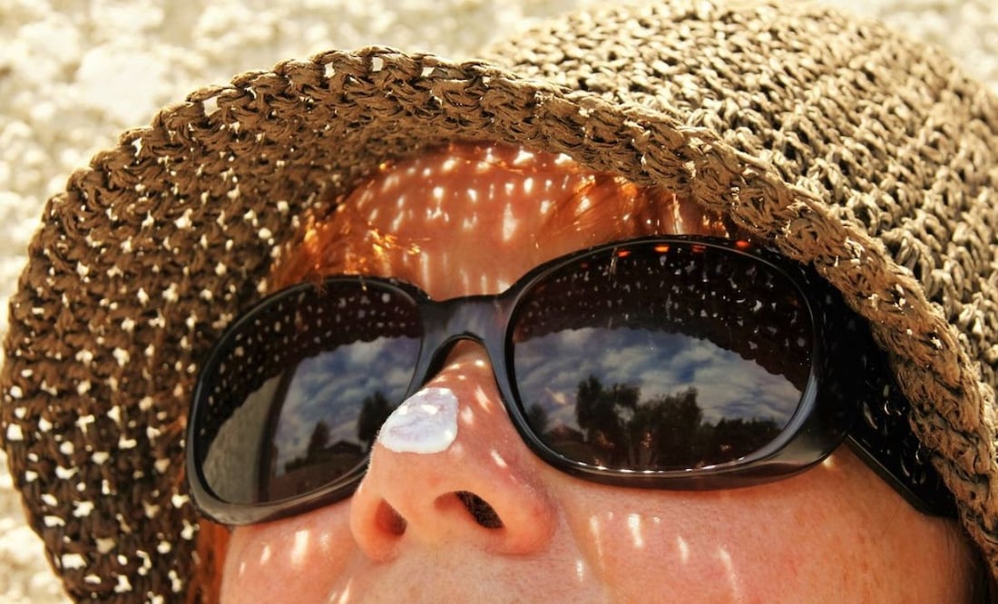 Manchas en la piel. Fuente: Pixabay