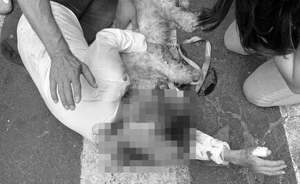 Perro pitbull ataca a una mujer y a su mascota en la Benito Juárez