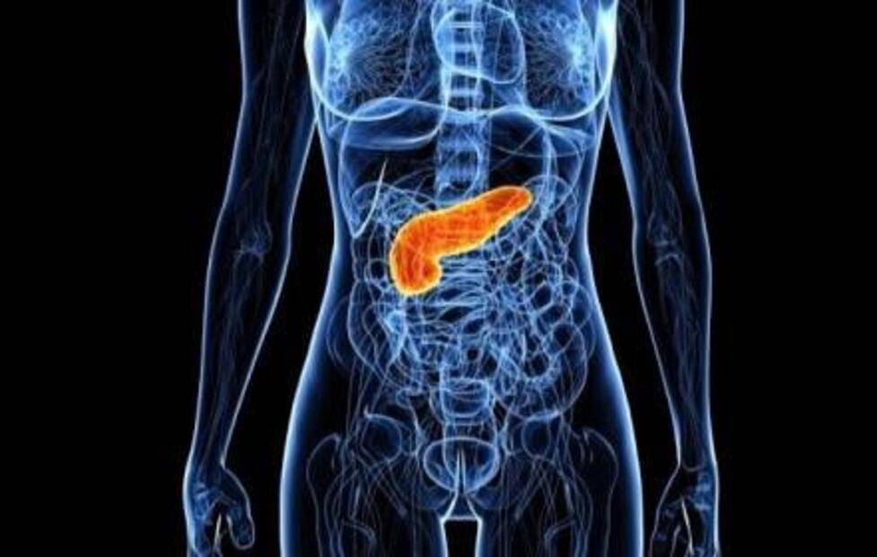 ¿Qué es la Pancreatitis Aguda?