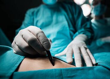 Tras cesárea a niña que fue violada, reavivan debate por aborto en Argentina