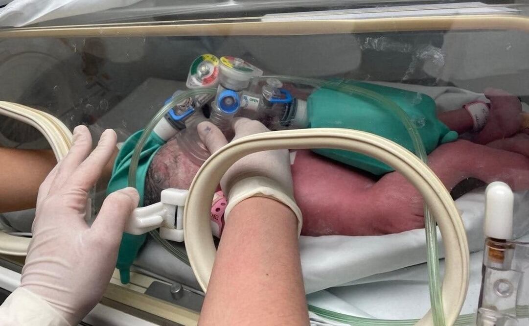 El Hospital Regional Materno Infantil inició todos los estudios complementarios requeridos para determinar el mejor tratamiento y seguimiento de las bebés. Foto: Especial