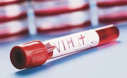 Eliminan VIH en seis pacientes con trasplante de células madre