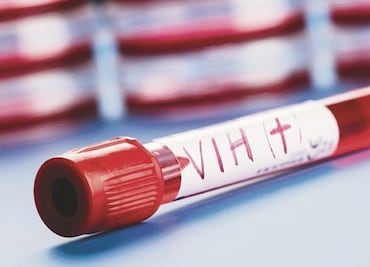 Eliminan VIH en seis pacientes con trasplante de células madre