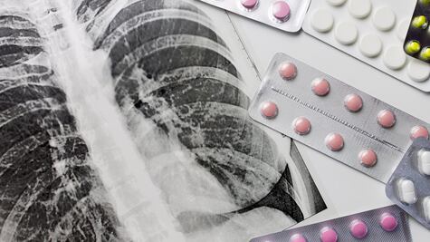 Millones de vidas están en peligro por fin de la ayuda de EU contra tuberculosis: OMS; países de bajos recursos dependen de ella