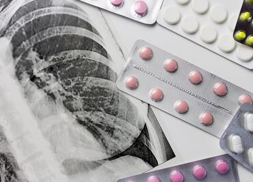 Millones de vidas están en peligro por fin de la ayuda de EU contra tuberculosis: OMS; países de bajos recursos dependen de ella