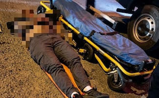 Investigan a mujer por presuntamente atropellar a su pareja en Mérida; la víctima sufrió lesiones graves