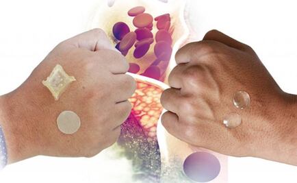 UNAM develops cholesterol-lowering transdermal patch