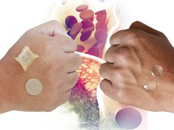 UNAM develops cholesterol-lowering transdermal patch