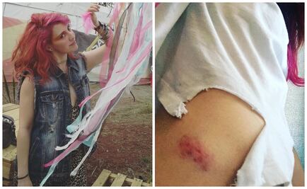 María Barracuda denuncia que fue golpeada al salir de una fiesta