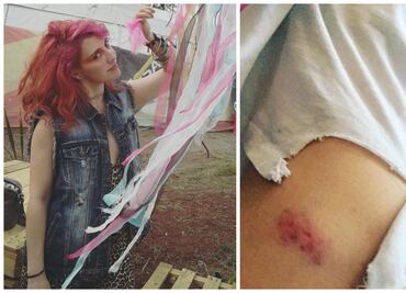 María Barracuda denuncia que fue golpeada al salir de una fiesta