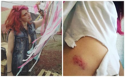 María Barracuda denuncia que fue golpeada al salir de una fiesta