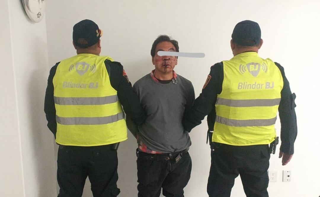 foto: Especial/El Universal/ Alba Arguello de 59 años, recibió una herida por arma punzocortante a la altura del ojo, por lo que tuvo un traumatismo ocular