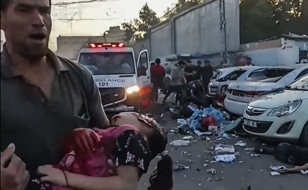 Imágenes de AFPTV muestran a civiles cargando a heridos ensangrentados. Foto: AFP