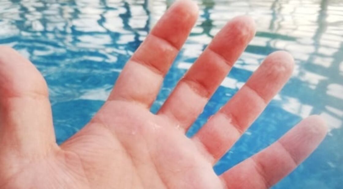 ¿Qué revelan de nuestra salud las arrugas de los dedos cuando se humedecen? 