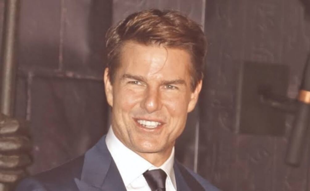 ¿Qué les pasó en la cara? Estos 5 artistas han recurrido a procedimientos estéticos