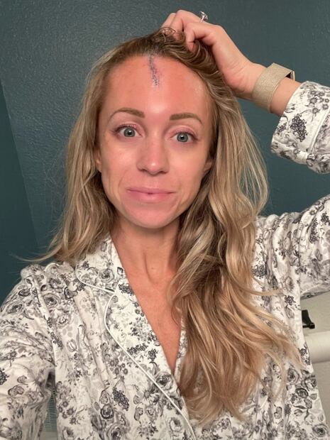 Reportera de los Rockies recibe pelotazo que iba a 150 km por hora