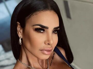 Lis Vega y la mala cirugía estética que le arruinó los labios