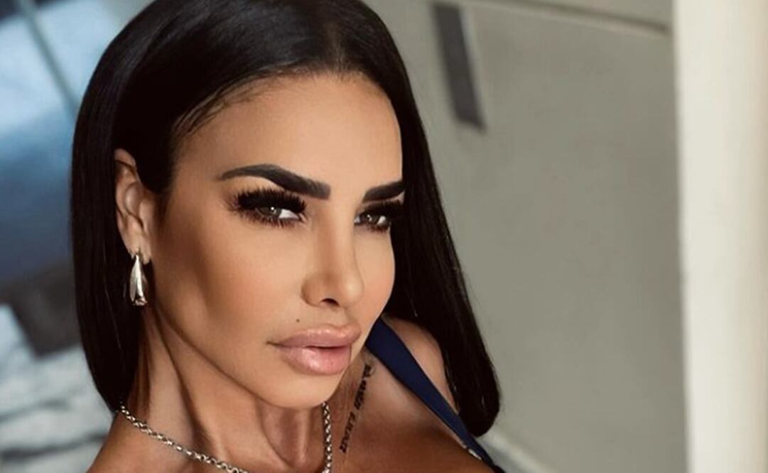 El aspecto de los labios de Lis Vega le han valido muchas críticas en redes sociales.