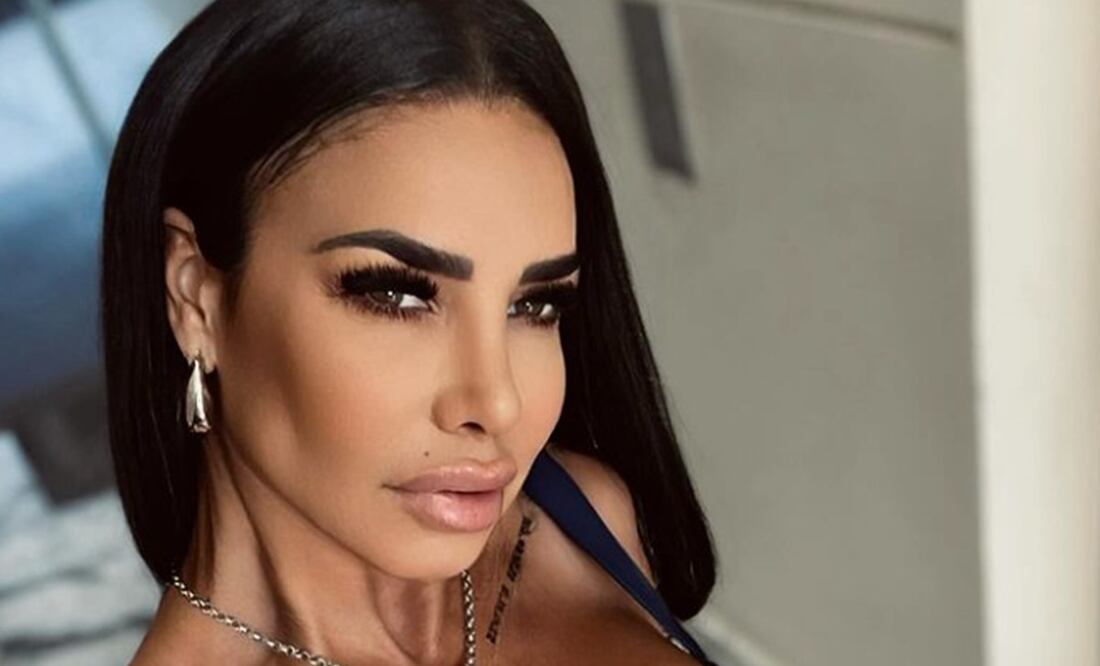 El aspecto de los labios de Lis Vega le han valido muchas críticas en redes sociales.