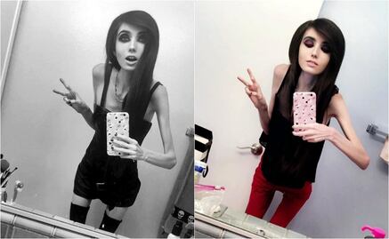 Youtuber causa polémica con su extrema delgadez