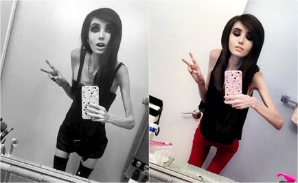 Youtuber causa polémica con su extrema delgadez