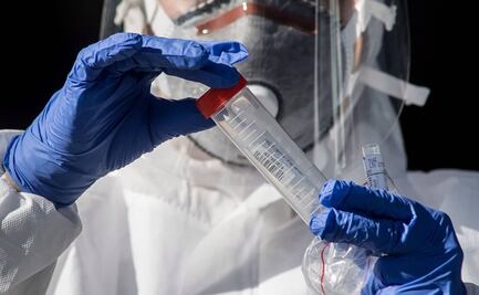 Vacuna de AstraZeneca y Oxford causa fuerte respuesta contra el Covid, según estudio