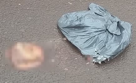 Abandonan piel de rostro humano en la autopista México-Pachuca