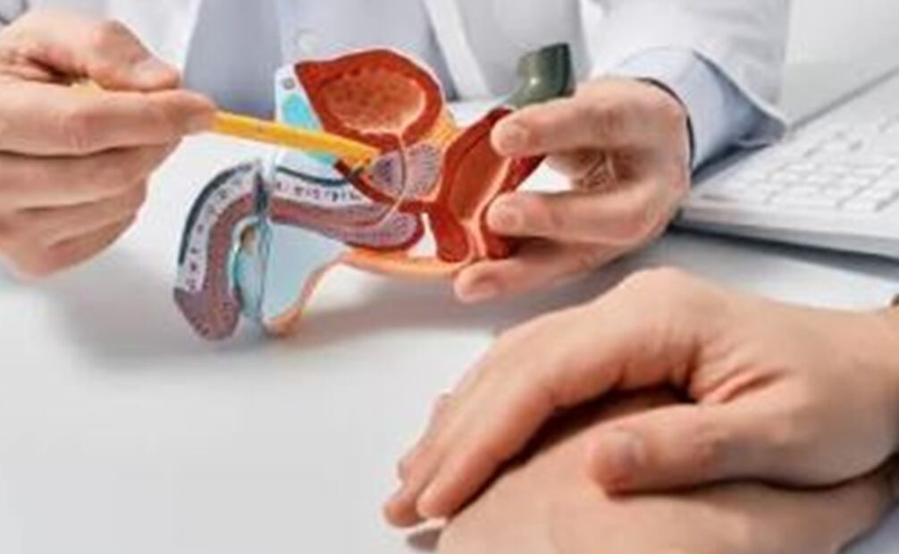 Cáncer de próstata. Foto: Pixabay