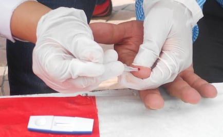 Muertes por sida, igual que hace 20 años