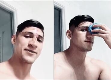 Alan Pulido sufre accidente y lo presume en redes