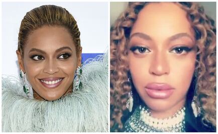 ¿Qué le pasó a los labios de Beyoncé?
