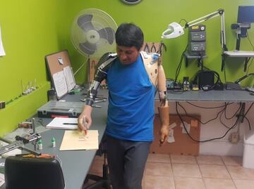 Diseñan prótesis biónicas de bajo costo