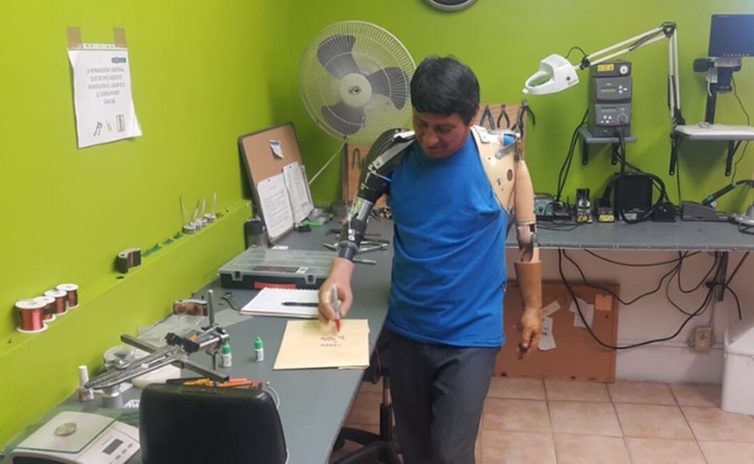 De acuerdo con estudios realizados por Probionics, en México alrededor de 10 mil personas al año pierden parte de un miembro superior. (FOTO: Conacyt)