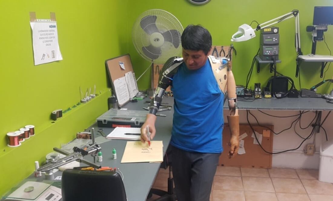 De acuerdo con estudios realizados por Probionics, en México alrededor de 10 mil personas al año pierden parte de un miembro superior. (FOTO: Conacyt)