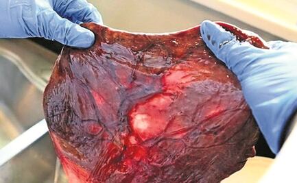 Descubren que microplásticos llegan hasta la placenta humana