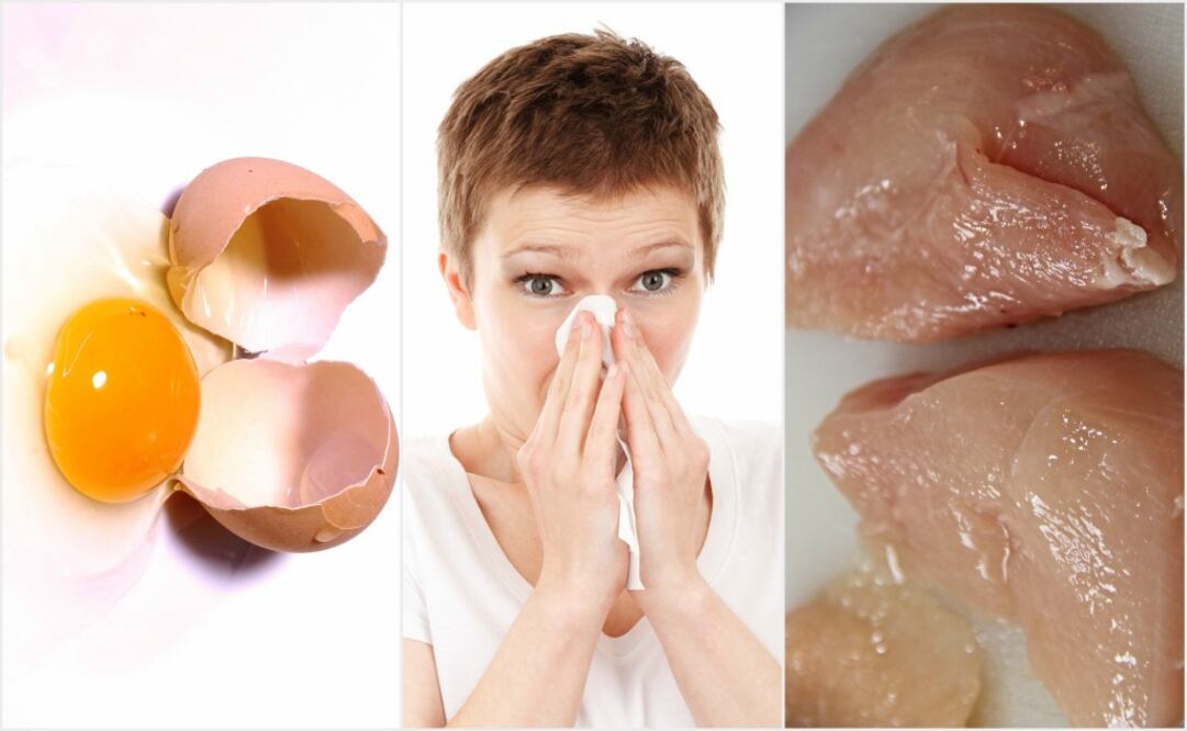 La carne de pollo y los huevos se pueden esterilizar al cocinarse bien. (Foto: Pixabay)