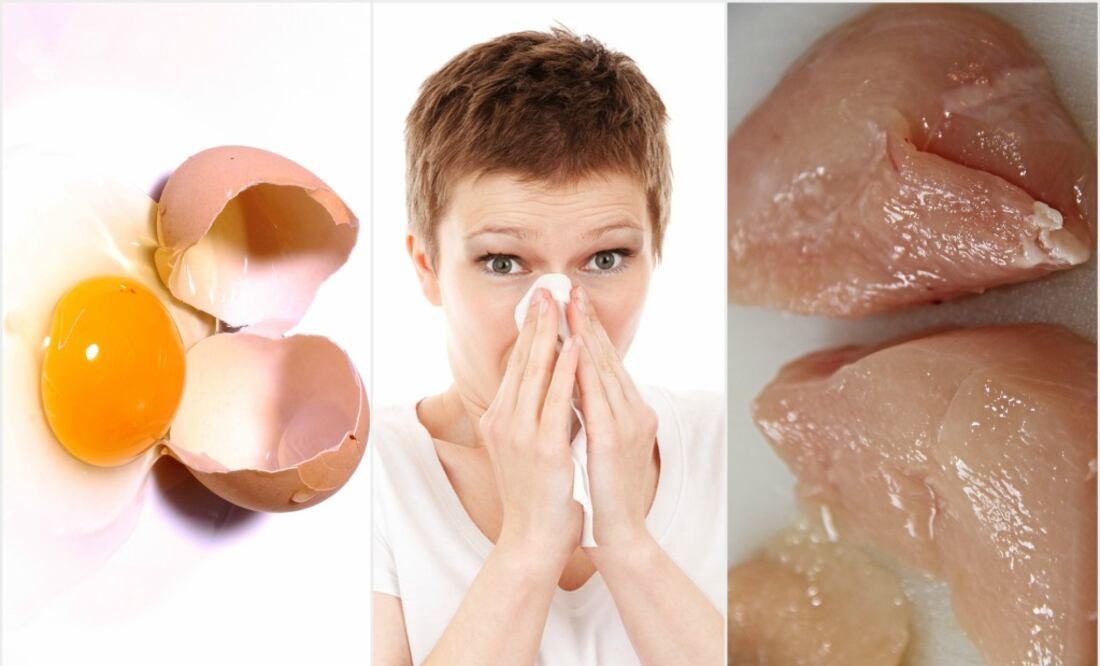 La carne de pollo y los huevos se pueden esterilizar al cocinarse bien. (Foto: Pixabay)