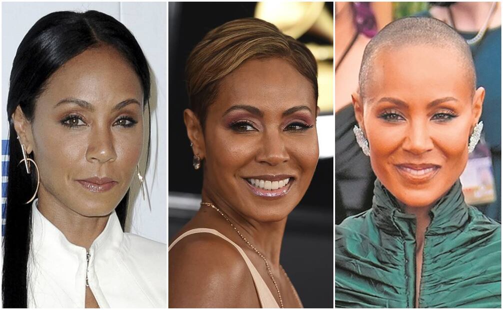 Jada Pinkett Smith sufre de alopecia desde 2018, la actriz ha hablado abiertamente de este problema por el que ha recibido burlas, como la de Chris Rock en los Oscar 2022 . Fotos: Agencias.