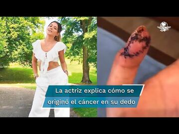 El calvario de Grettell Valdez empezó con una manicura realizada con instrumentos sin limpiar