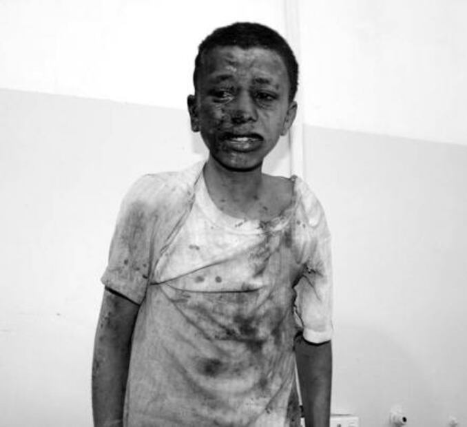 Mueren al menos 29 niños en ataque contra autobús en Yemen