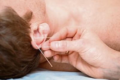 Auriculoterapia: para tratar enfermedades crónicas