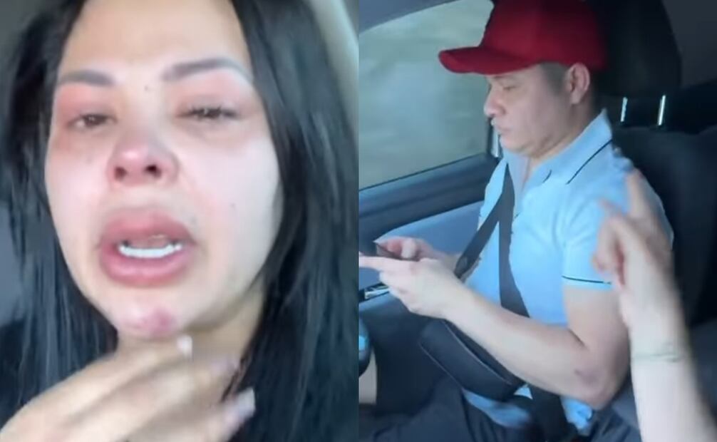 Fernanda Redondo Cortés exhibe presuntos golpes de Rafa González García. Foto: Vía TikTok.