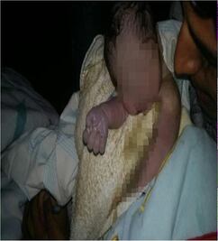 Policías ayudan a mujer a dar a luz en la calle en la Portales