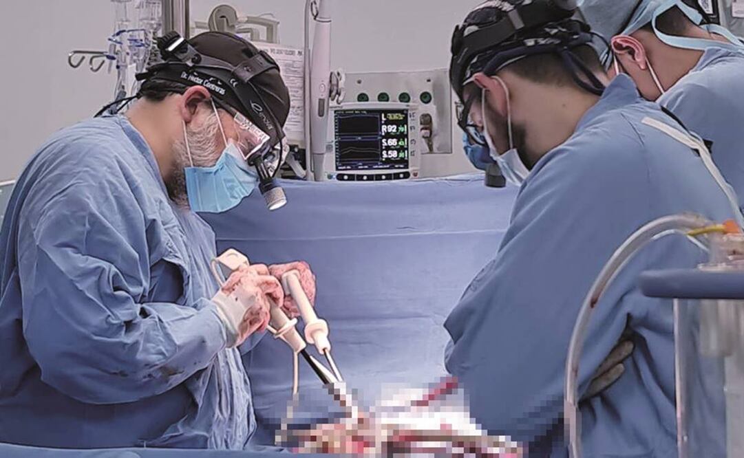 La beneficiaria fue una mujer oriunda de Tampico, Tamaulipas, que estaba diagnosticada con enfermedad pulmonar.