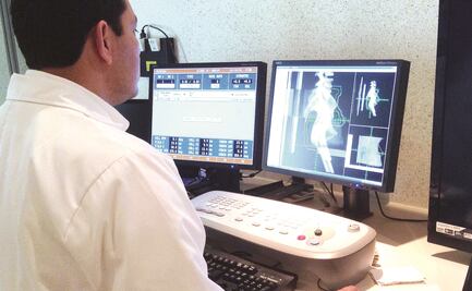 Descubren subtipos de síndrome de ovario poliquístico