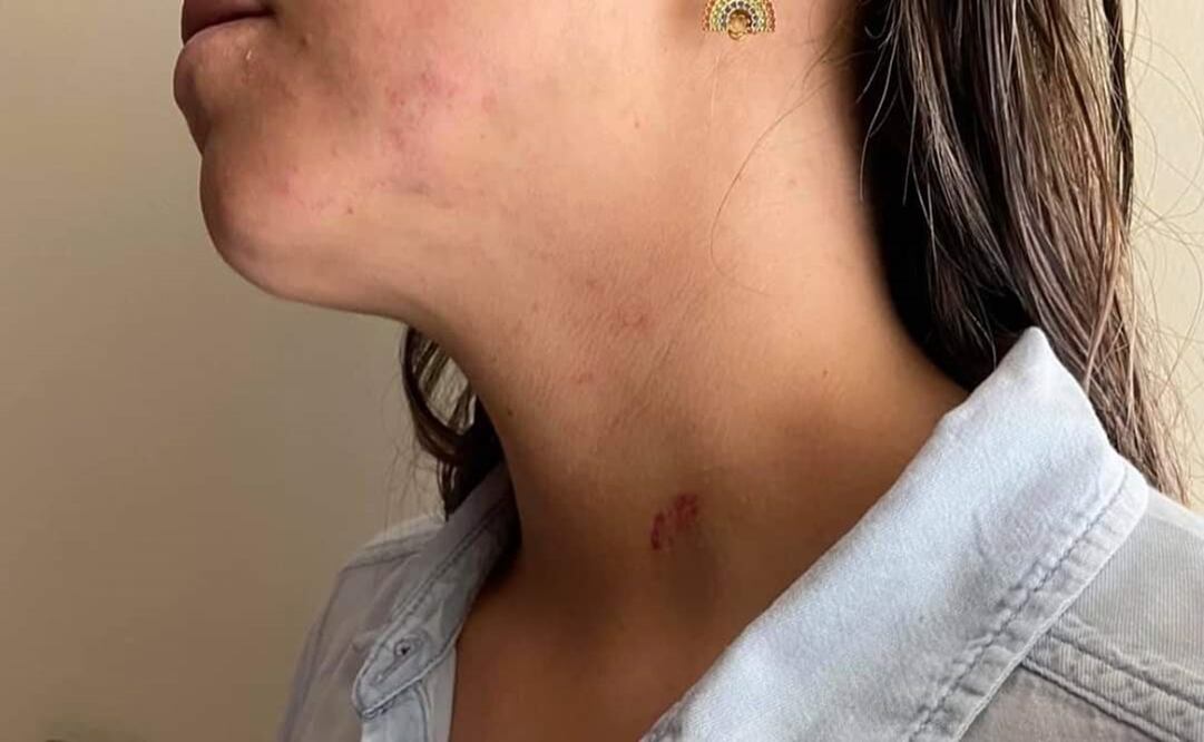 Foto: Facebook Kenya Mirelle